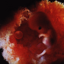 1 november 2001 10 weken